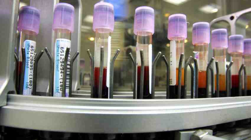 You are currently viewing Researchers Develop First Blood Test to Accurately Diagnose Depression and Schizophrenia
