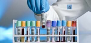 Read more about the article Human Testing Starts for Experimental Coronavirus Vaccine in the US