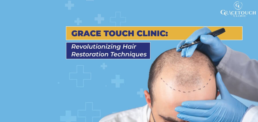 You are currently viewing Grace Touch Clinic: Revolutionizing The Journey of Innovative Hair Restoration